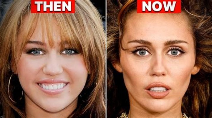Mori Calliope Real Face: What Surgery Did She Get?