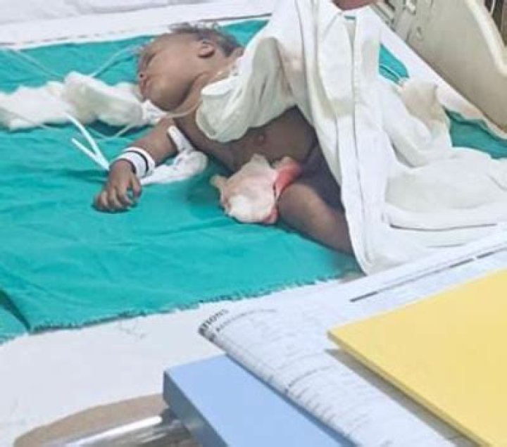 
Toddler dies after being attacked by stray dogs in Noida 